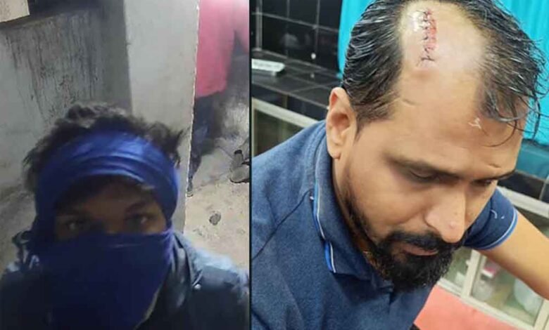 छत्तीसगढ़-कोरबा में पकड़ते समय चोरों के पथराव में दो युवकों को आई गंभीर चोट 1 KSHITITECH Cg 09 2 KSHITITECH