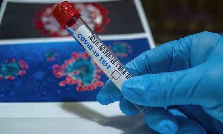 बिलासपुर में एक साथ मिले कोरोना के 10 मरीज, स्वास्थ्य विभाग अलर्ट 1 KSHITITECH corona1 2 KSHITITECH