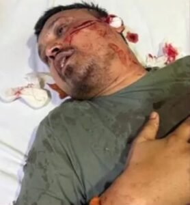 रायपुर सेंट्रल जेल में कांग्रेसी नेता पर धारदार हथियार से जानलेवा हमला, हालत नाजुक 3 KSHITITECH img 20250718 wa00524057585886786994078 KSHITITECH